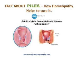 Fact about piles- how homeopathy helps to cure it.pdf